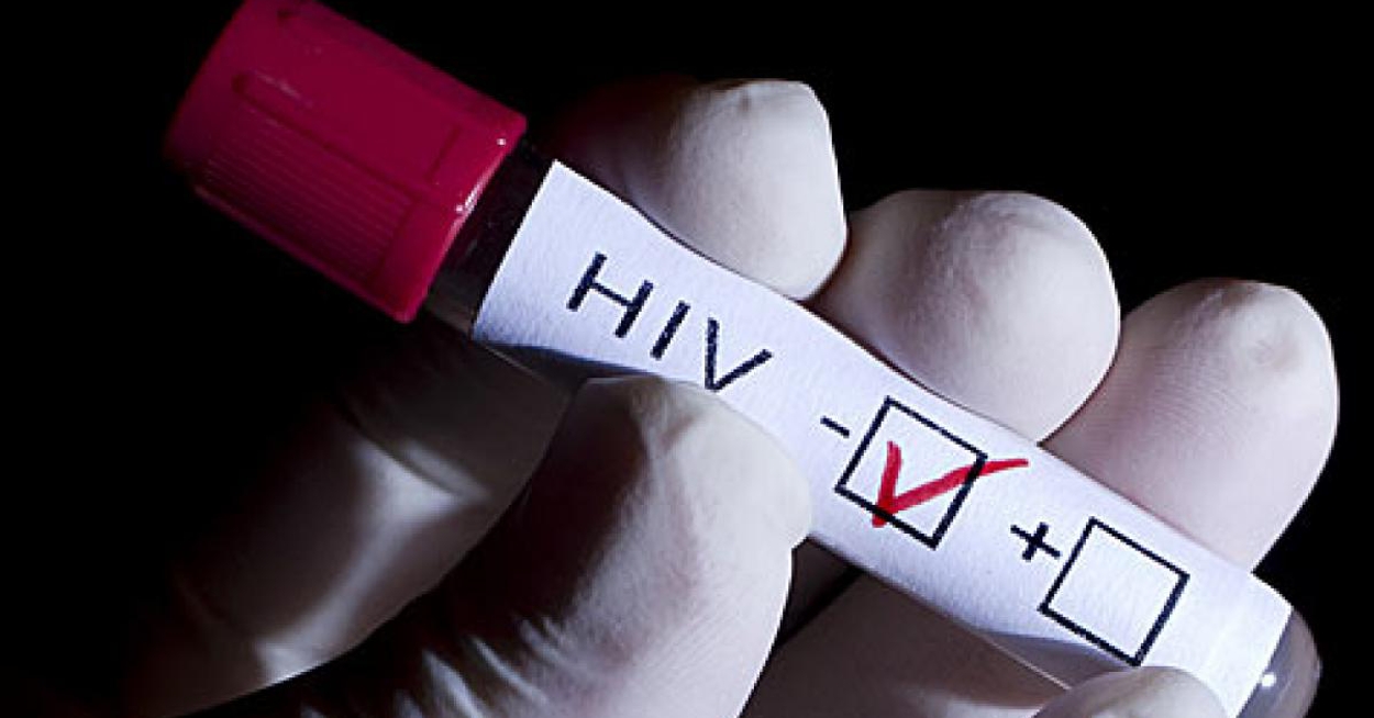 Afbeelding van Test thuis of je hiv hebt
